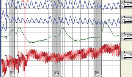 polygraph exam in Los Angeles for $150